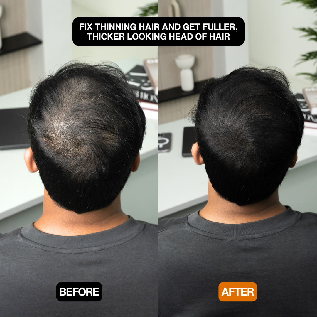 Natural Hair Touch-Up for Men & Women - Apply Daily