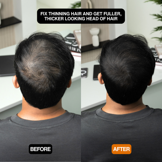 Natural Hair Touch-Up for Men & Women - Apply Daily