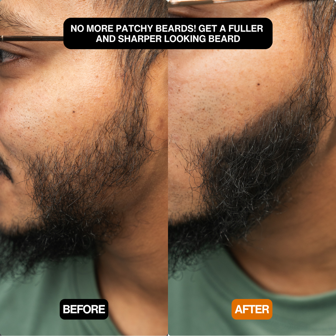 Natural Hair Touch-Up for Men & Women - Apply Daily
