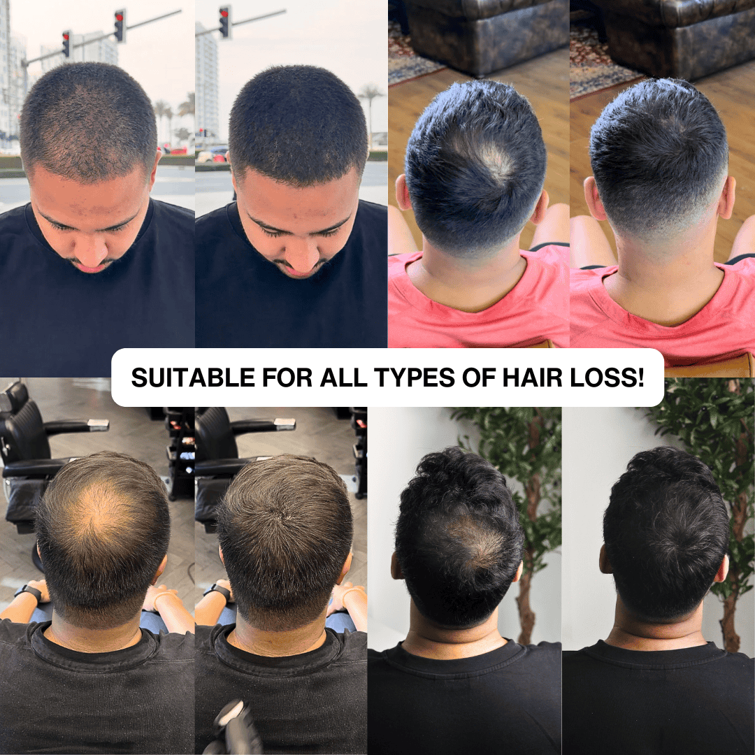 Natural Hair Touch-Up for Men & Women - Apply Daily