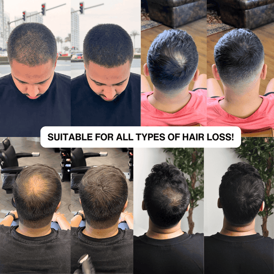 Natural Hair Touch-Up for Men & Women - Apply Daily