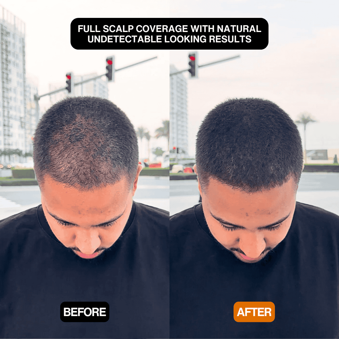 Natural Hair Touch-Up for Men & Women - Apply Daily